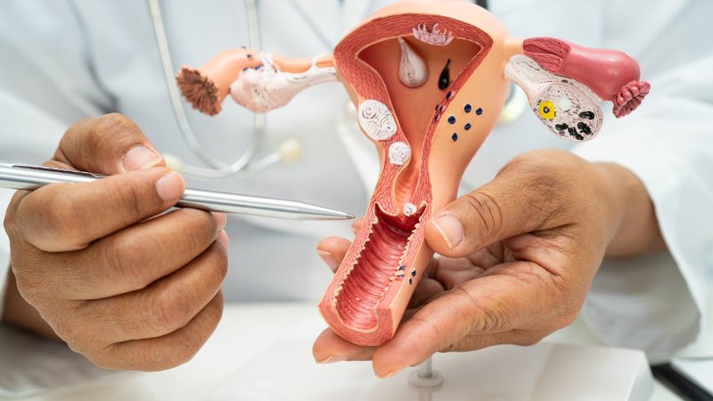 Como o Ciclo Menstrual Afeta Seus Treinos (E Como Ajustar Cada Fase)