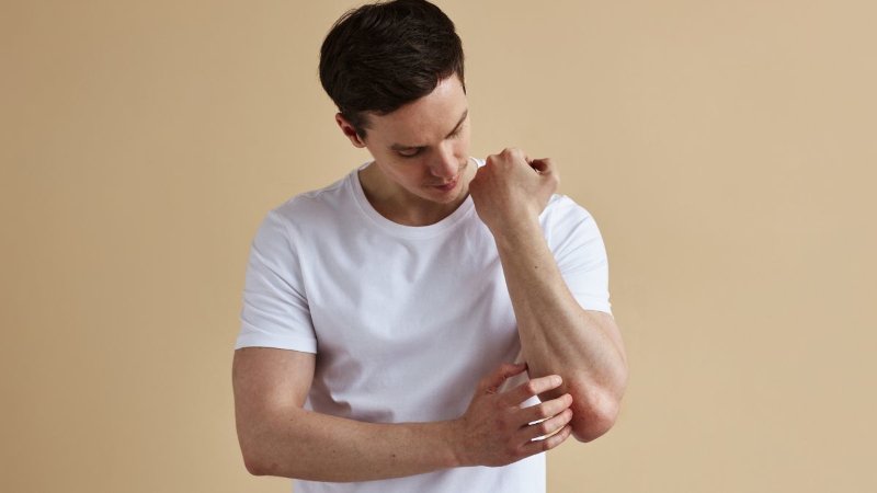 Psoríase Tem Tratamento? Como Controlar os Sintomas e Recuperar Qualidade de Vida