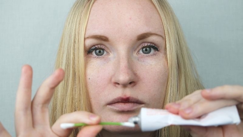 Pomadas e Colírios para Terçol: Funcionam Mesmo?