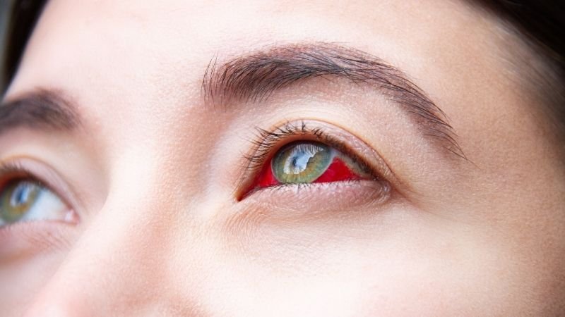 Ceratite: Sintomas, Causas e Tratamentos Atualizados