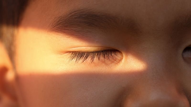 👁️ Fotofobia: Quando a Sensibilidade à Luz é Preocupante