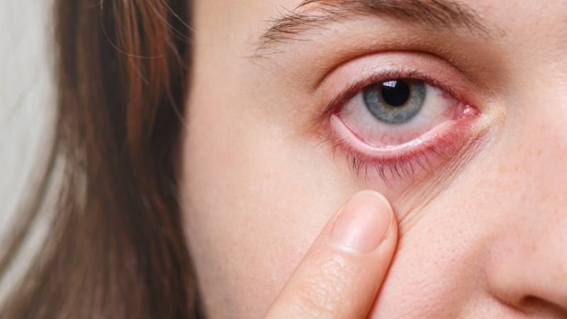 👁️ Sensibilidade à Luz e Olhos Vermelhos: Combinação Perigosa?