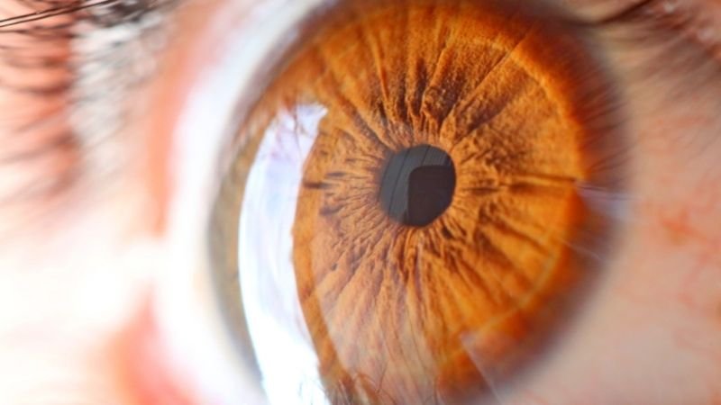 Esclerose Múltipla e Visão: Os Primeiros Sintomas Podem Aparecer nos Olhos