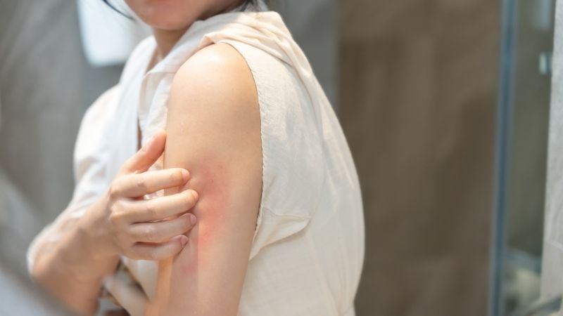 🧴 Coceira na Pele: O Que Pode Ser, Principais Causas e Como Aliviar o Prurido
