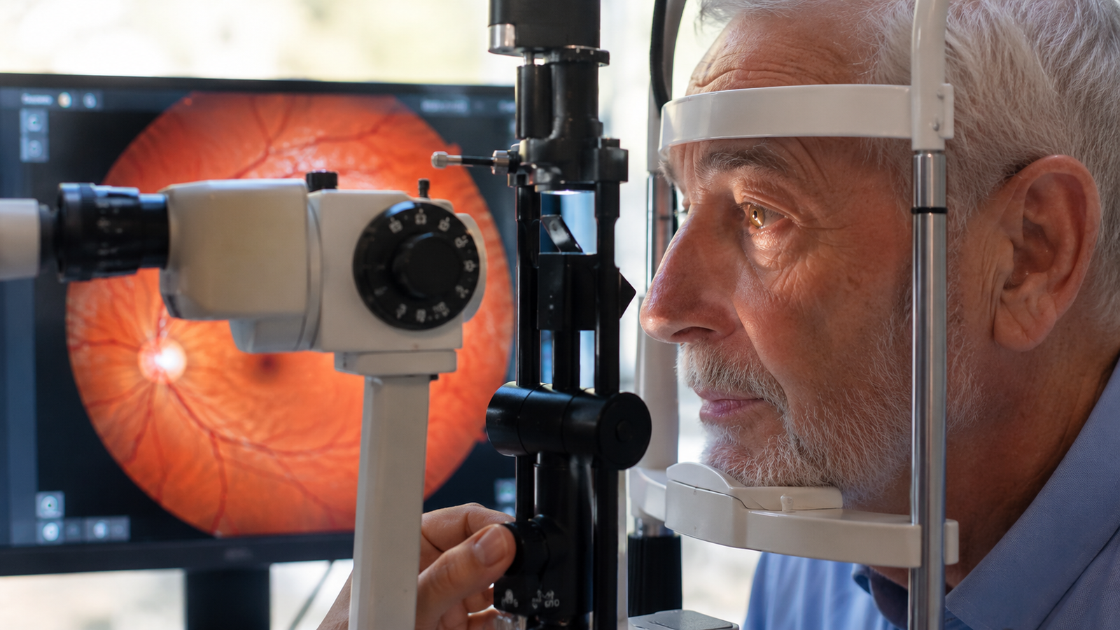 Retinopatia Hipertensiva: Como a Pressão Alta Afeta Seus Olhos e a Visão